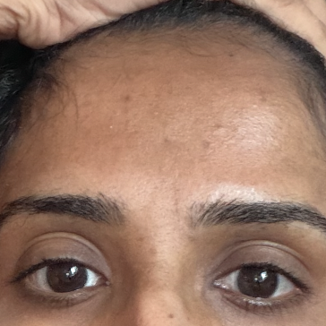 Secondary image
